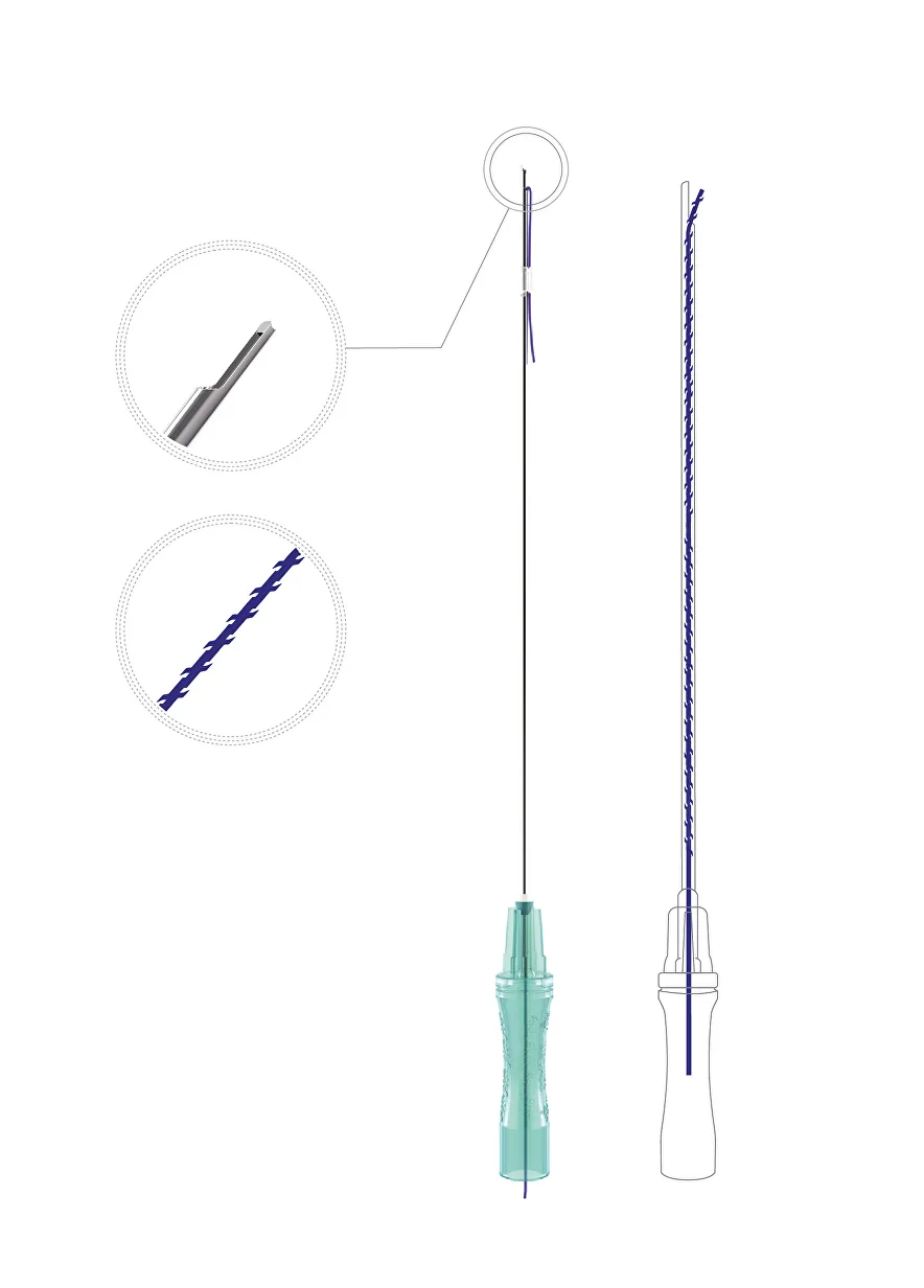 360C 19-100-150 Мезонить Коги (Cobra) полидиоксаноновая The Up в канюле с иглой /4D Thread IROXIN