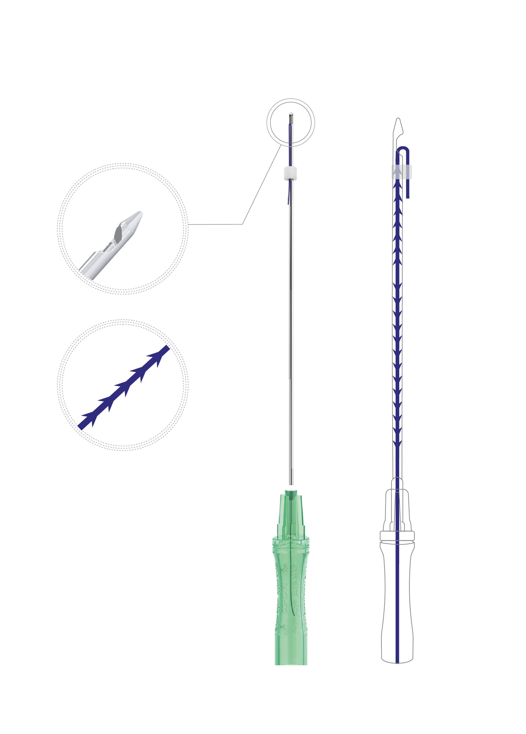 CC 18-100-150 Полидиоксаноновая мезонить Triangle Cog с формованными треуг.зубцами /4D Thread IROXIN