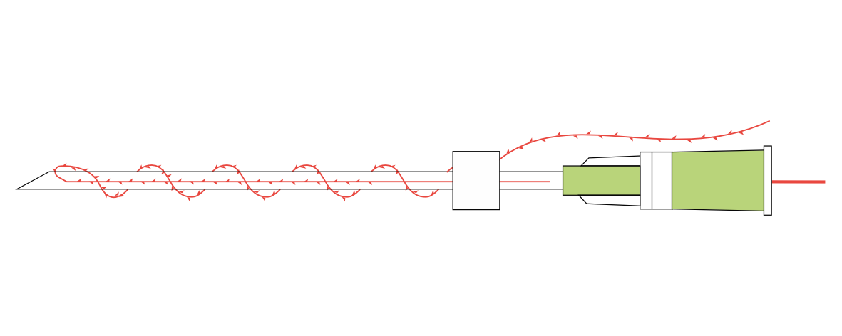PLACL COG-SCREW 25G/60mm, (острая игла) 4шт/уп Лифтинговая нить коги Сополимер /DG-lift