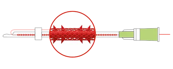 PLACL COG SC-type MESH LIFTING 18G-100мм 4шт/уп каркасн.цельнолитая с оформов.зубц+ 3D-сеть /DG-lift