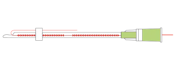 PLACL COG 18G/100mm (L канюля) 4шт/уп Лифтинговая нить коги Сополимер /DG-lift